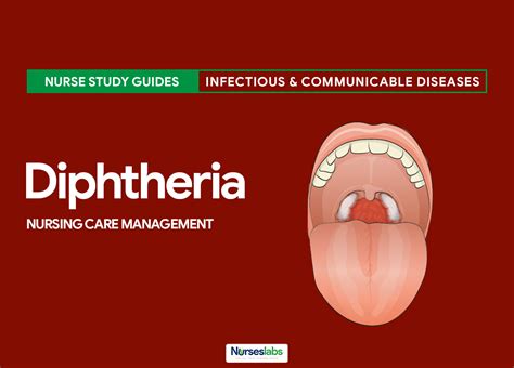 Diphtheria .